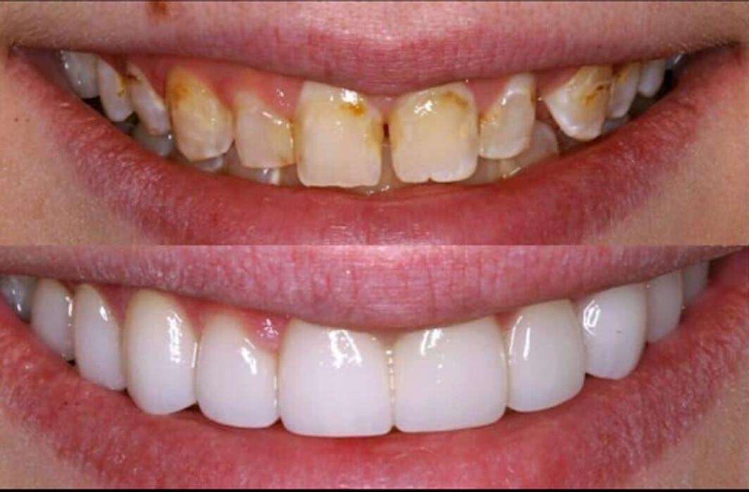 Images West Brickell Dental