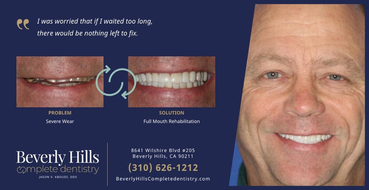 Images Beverly Hills Complete Dentistry