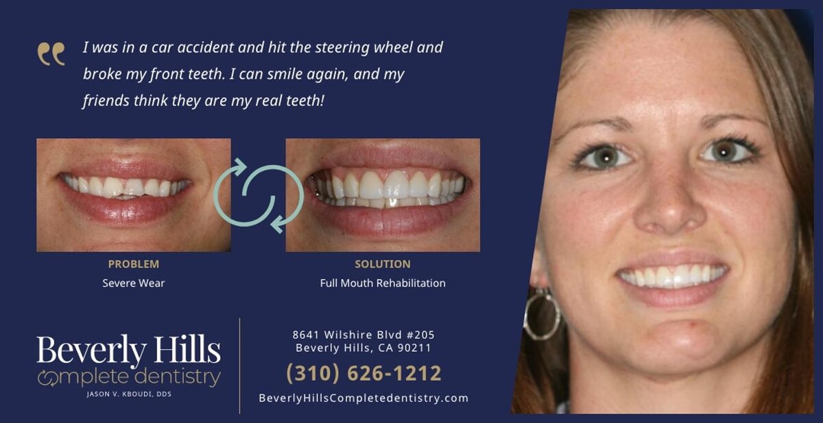 Images Beverly Hills Complete Dentistry