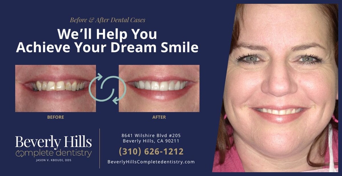 Images Beverly Hills Complete Dentistry