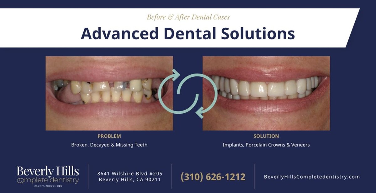 Images Beverly Hills Complete Dentistry