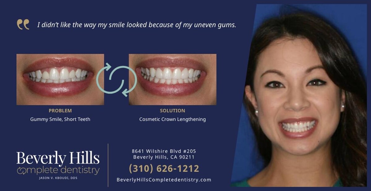 Images Beverly Hills Complete Dentistry