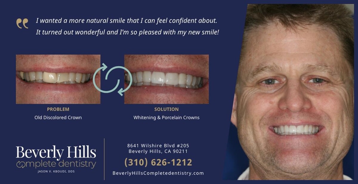 Images Beverly Hills Complete Dentistry