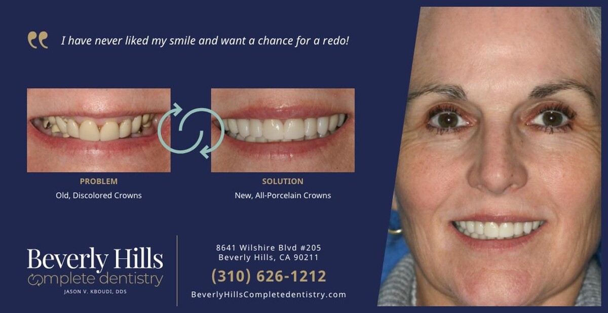 Images Beverly Hills Complete Dentistry