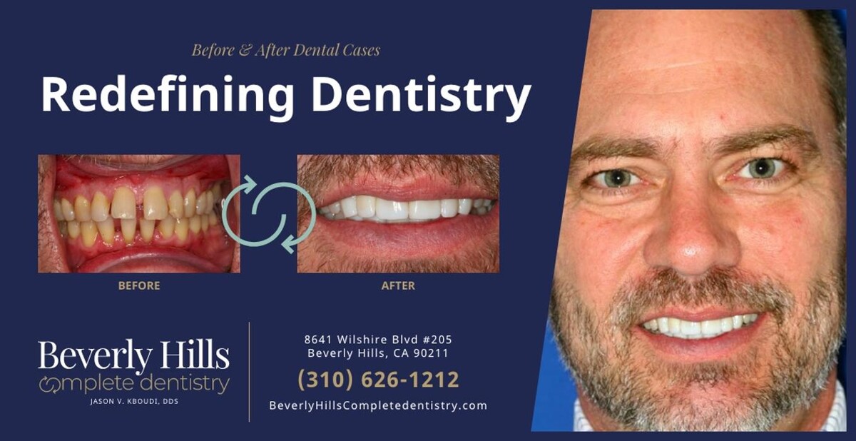 Images Beverly Hills Complete Dentistry
