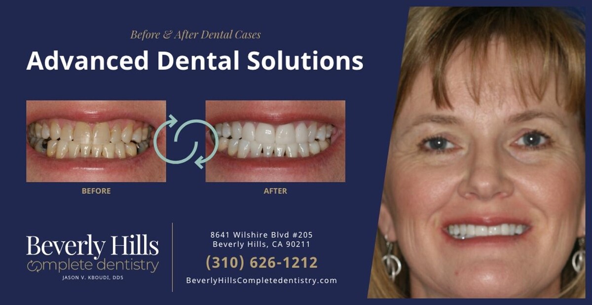 Images Beverly Hills Complete Dentistry