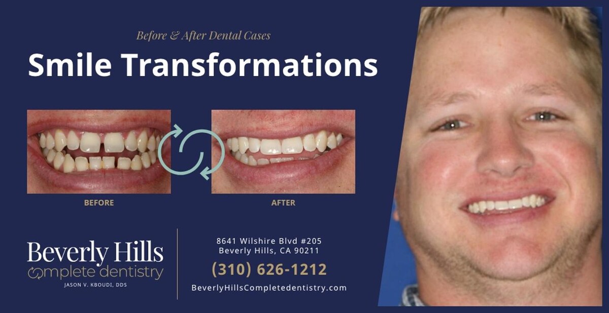 Images Beverly Hills Complete Dentistry