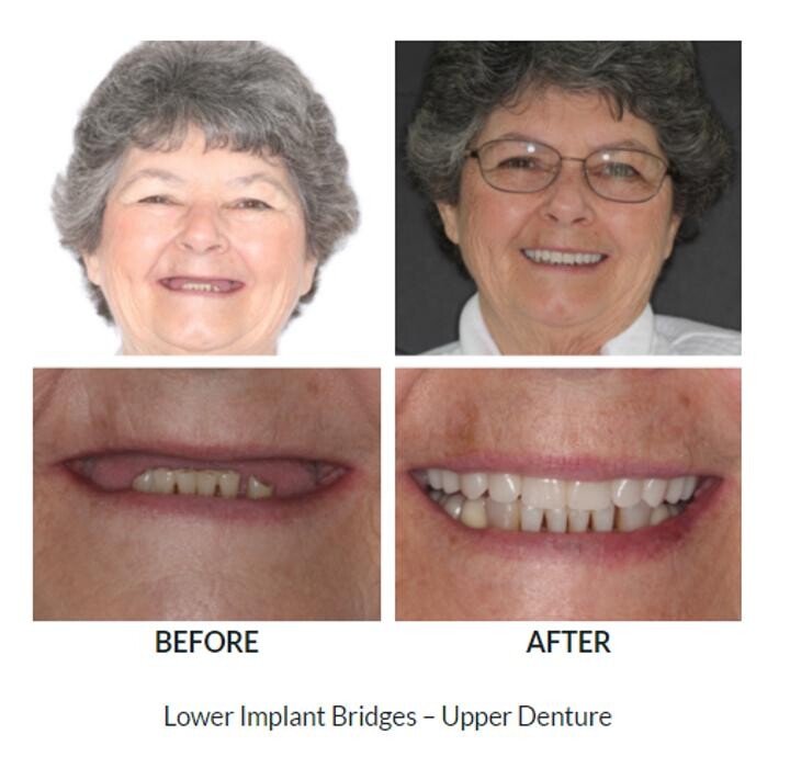 Images Mirelez Wellness Dental