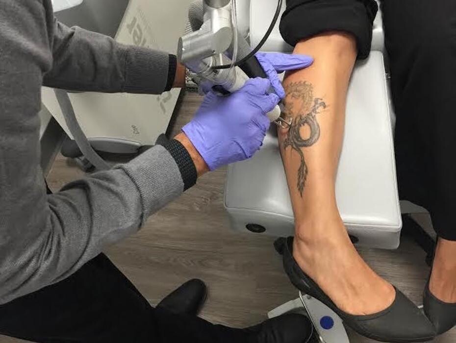 Images Removery Tattoo Removal & Fading