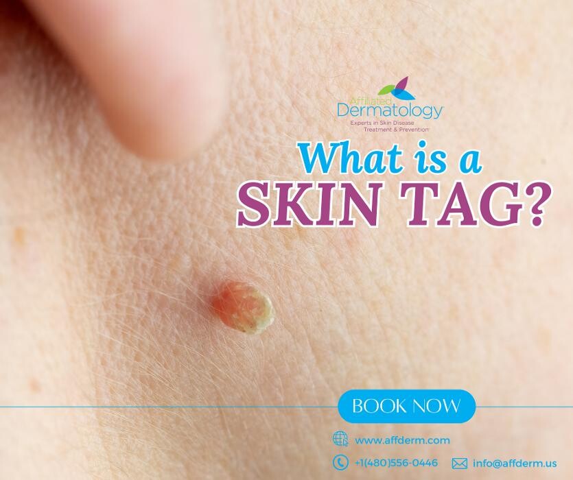 Images Affiliated Dermatology Tolleson