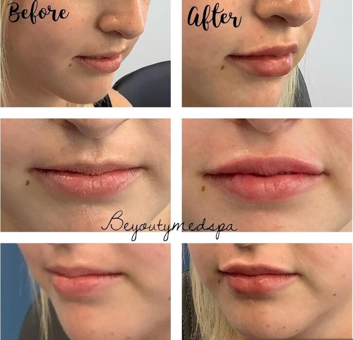 Images BeYouty Medical Spa
