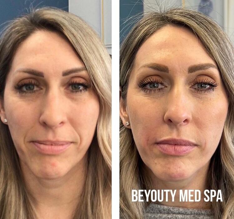 Images BeYouty Medical Spa