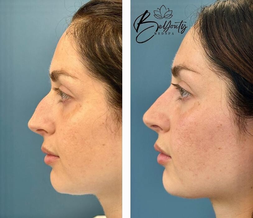 Images BeYouty Medical Spa