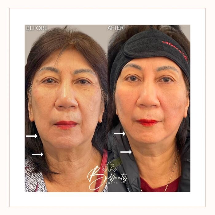 Images BeYouty Medical Spa