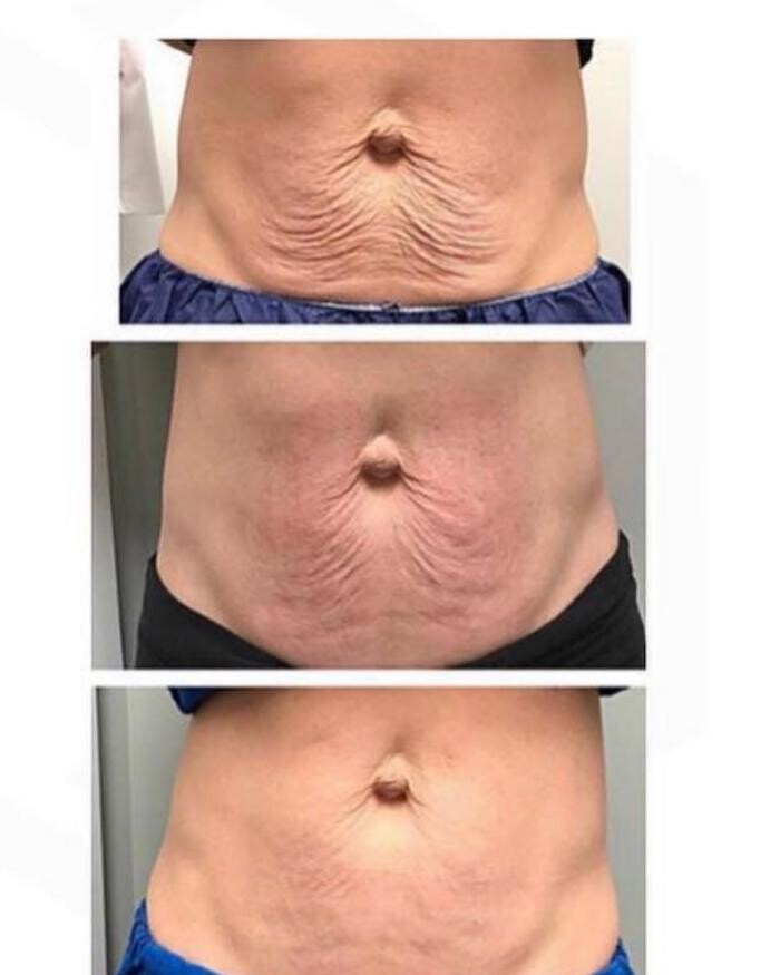 Images Grace Medspa & Body Solutions