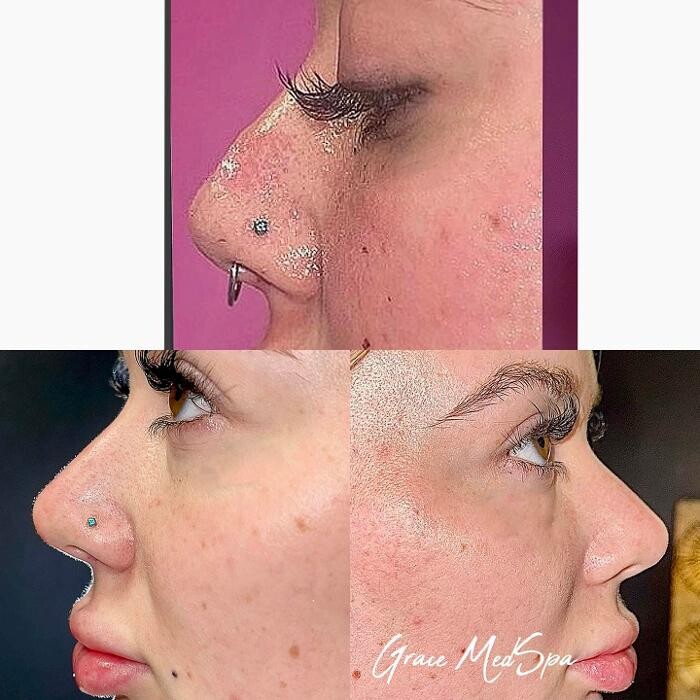 Images Grace Medspa & Body Solutions