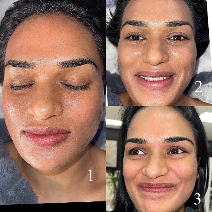 Images Grace Medspa & Body Solutions