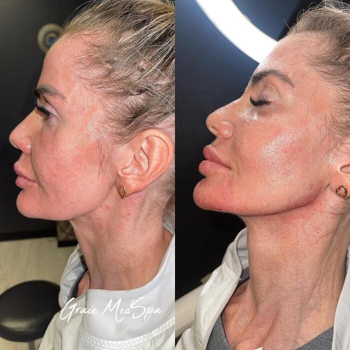 Images Grace Medspa & Body Solutions