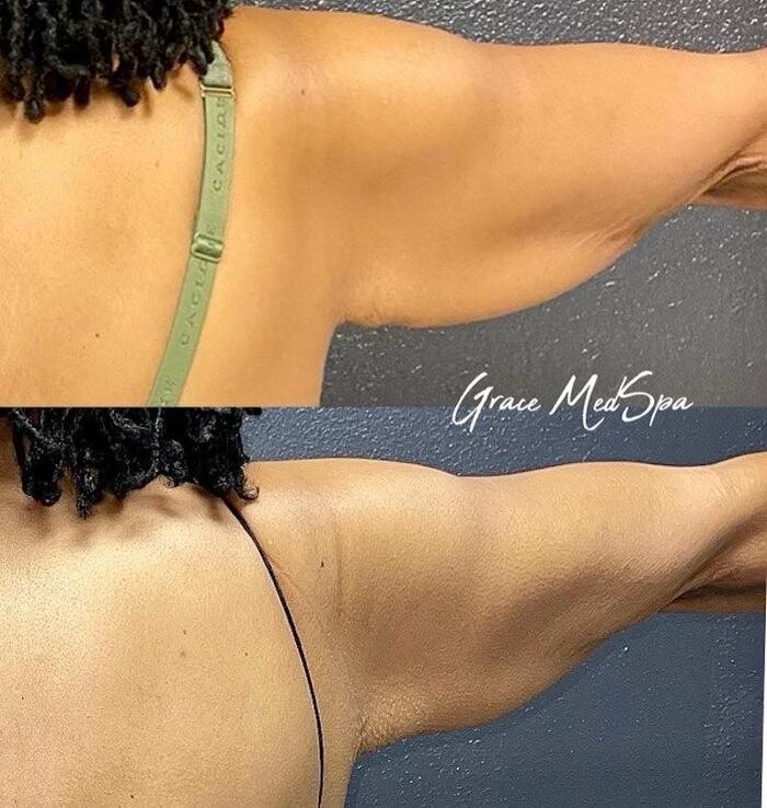 Images Grace Medspa & Body Solutions