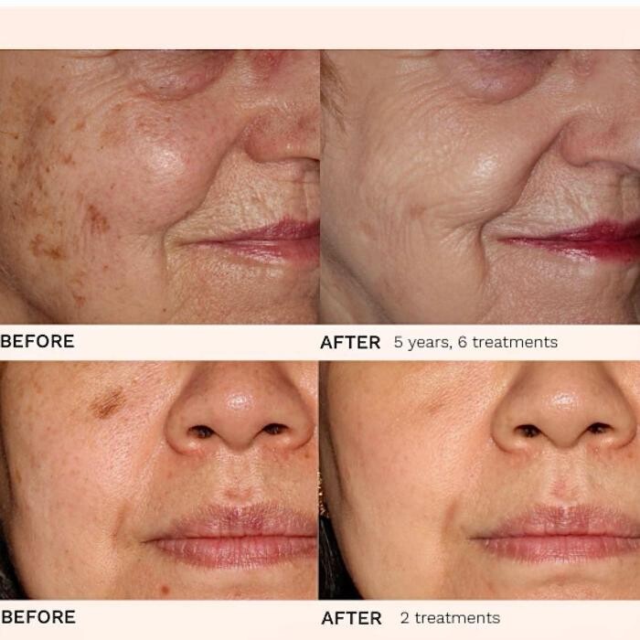 Images Grace Medspa & Body Solutions