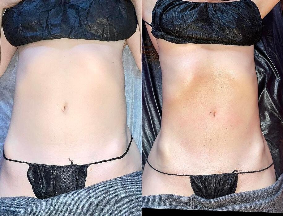 Images Grace Medspa & Body Solutions