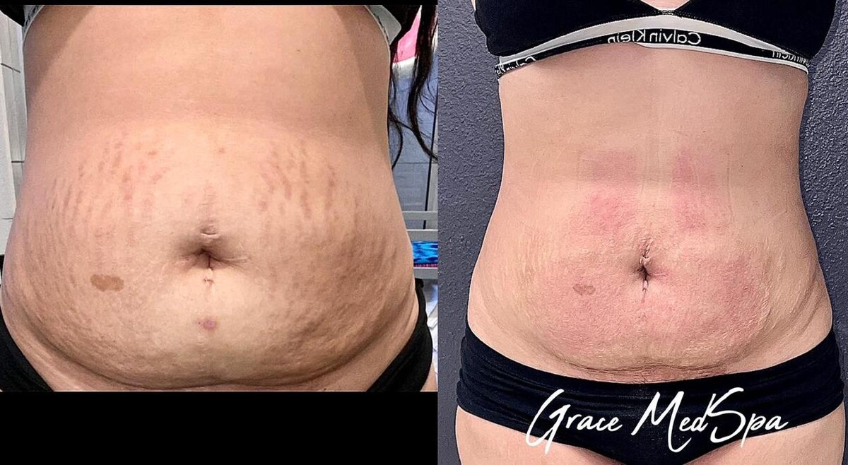 Images Grace Medspa & Body Solutions