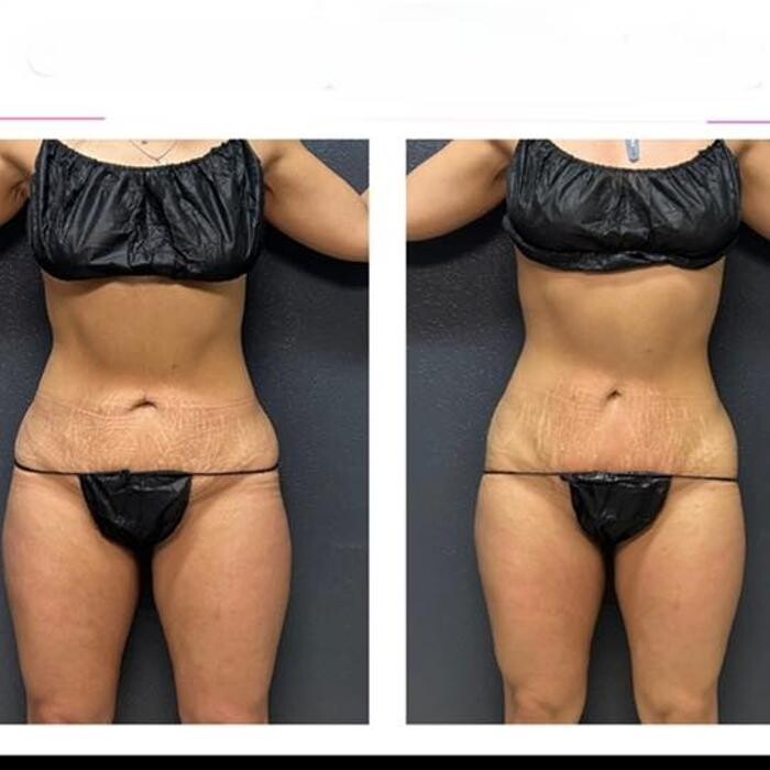 Images Grace Medspa & Body Solutions