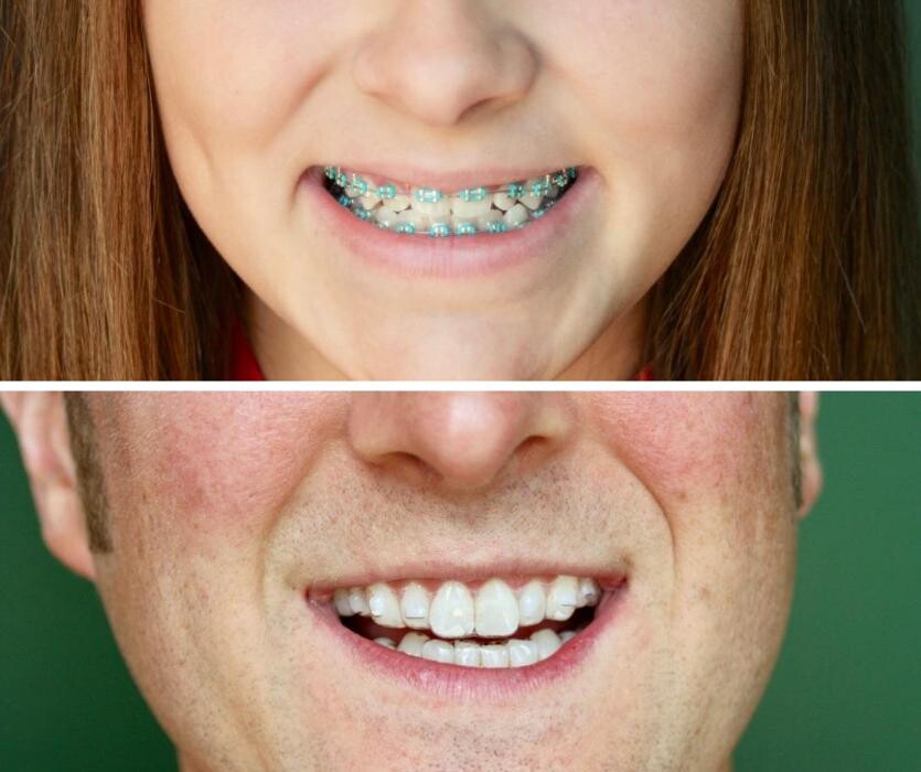 Images Rochester Family Orthodontics