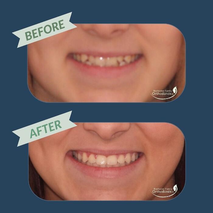 Images Rochester Family Orthodontics