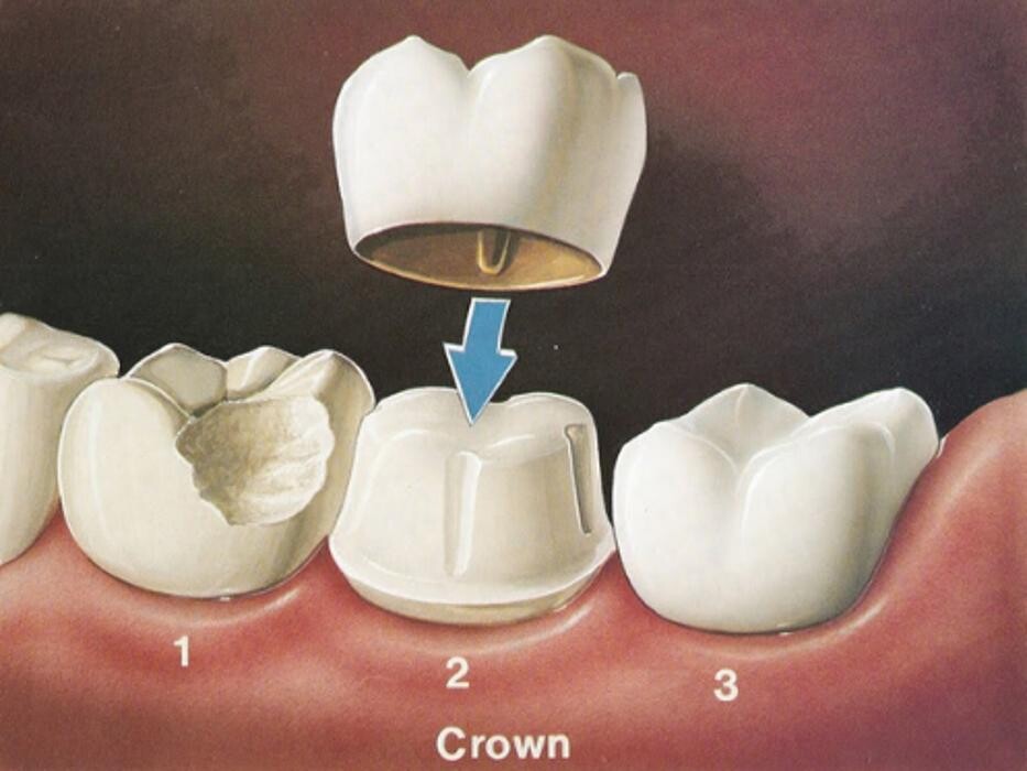 Images Bandy Dental