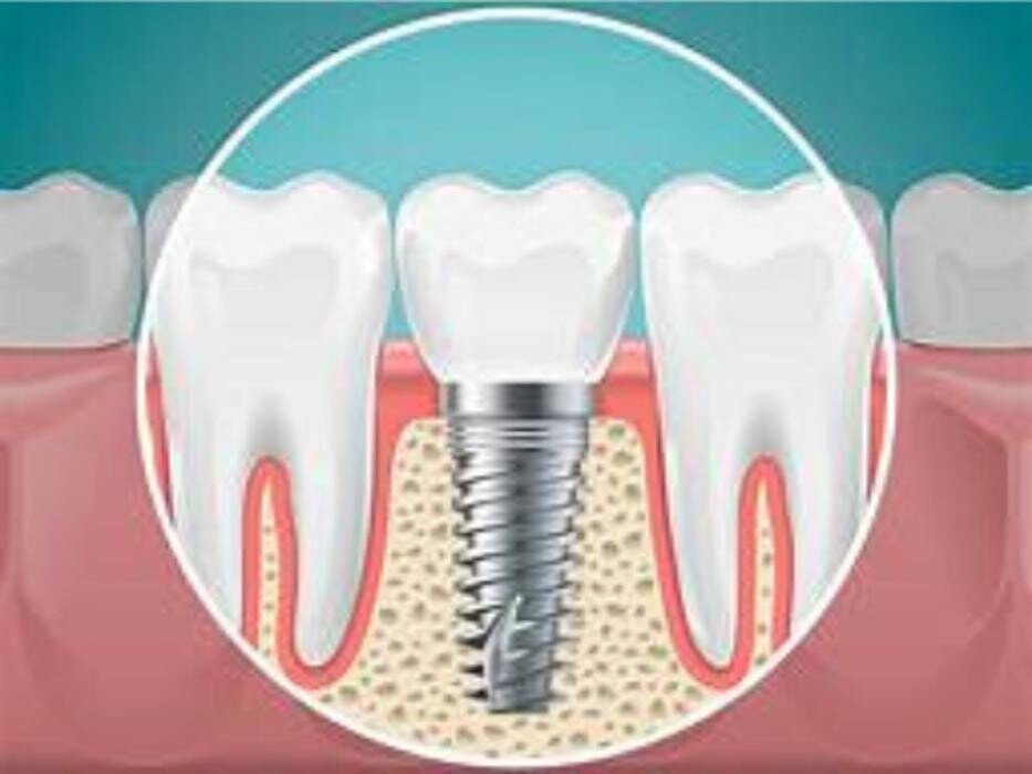 Images Bandy Dental