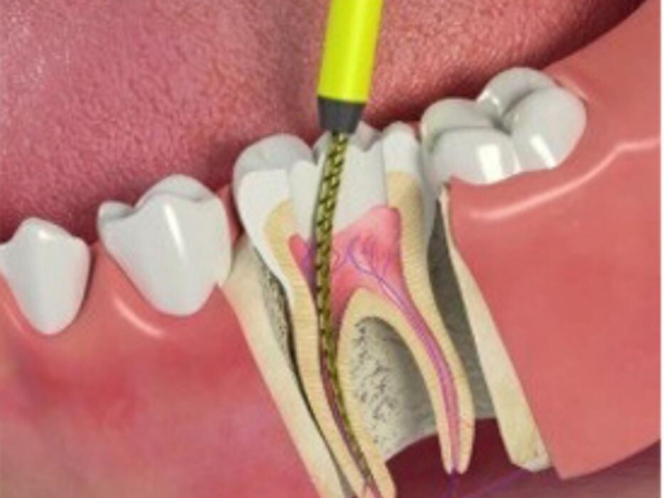 Images Bandy Dental