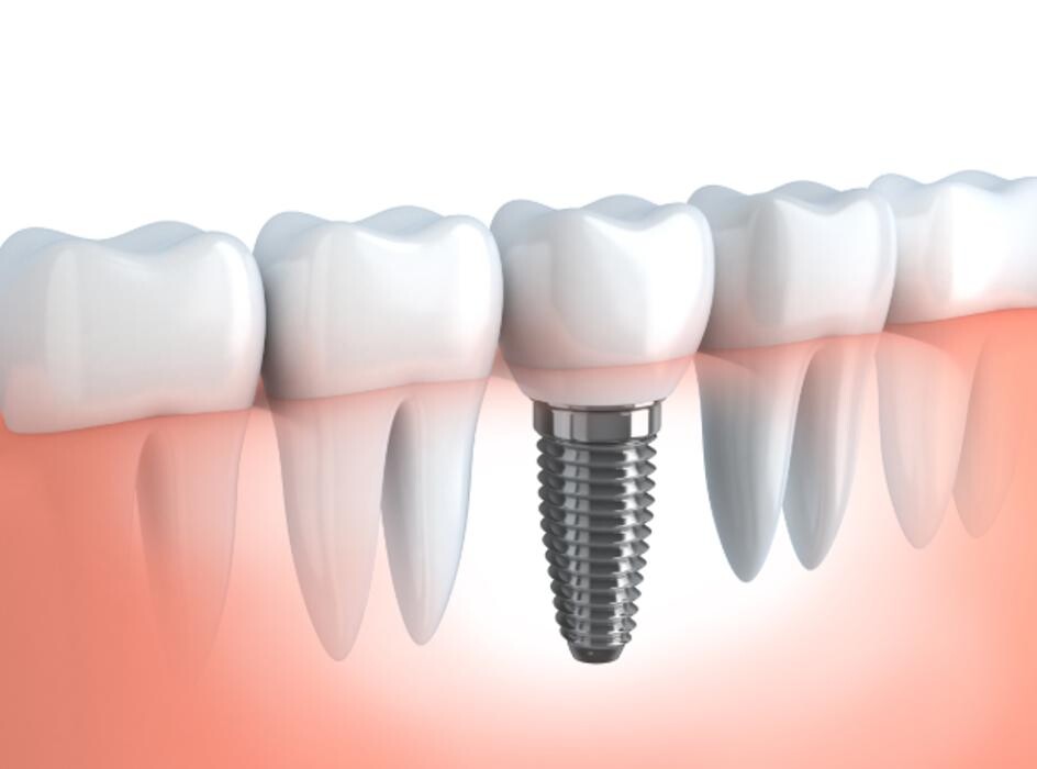 Images Riverview Family Dental