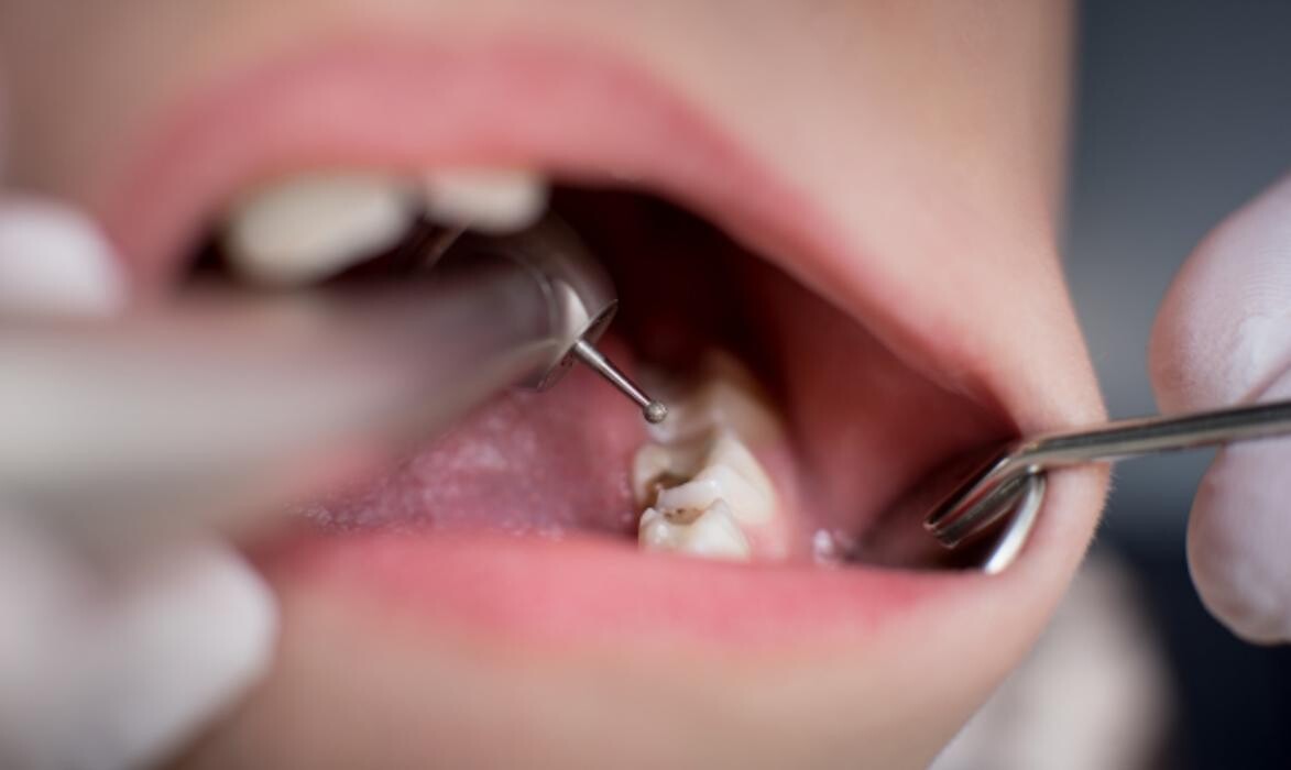 Images Riverview Family Dental