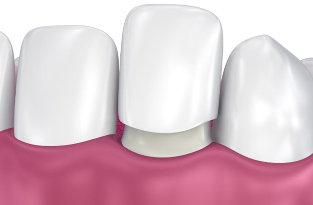 Images Riverview Family Dental