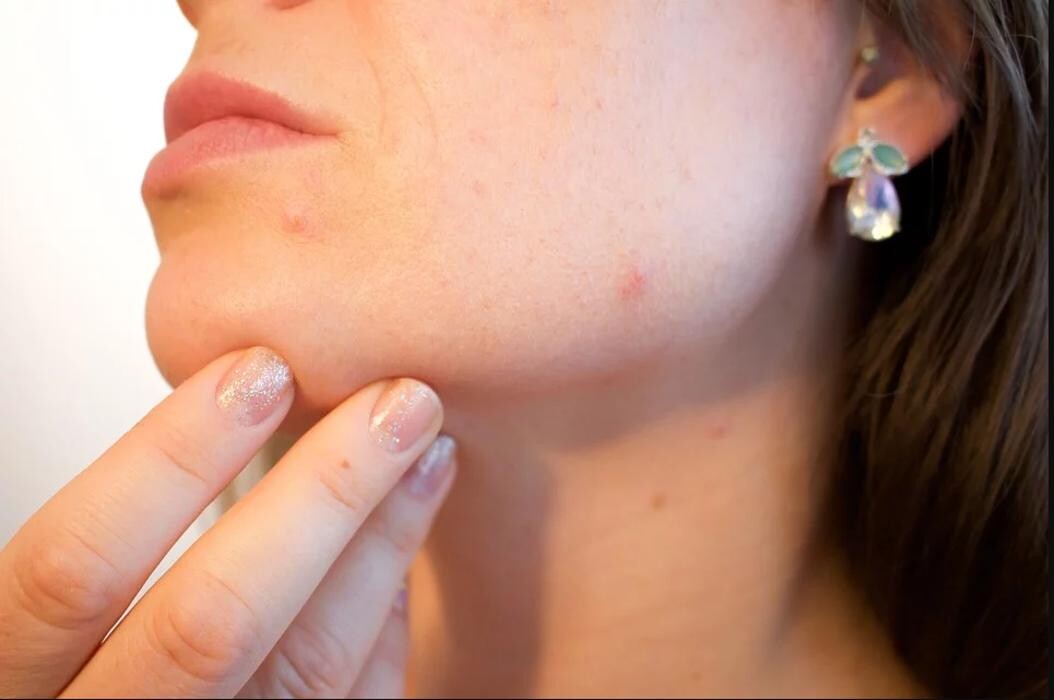 Images Fox Valley Dermatology, SC