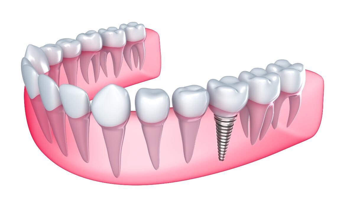 Images Periodontics, P.C.