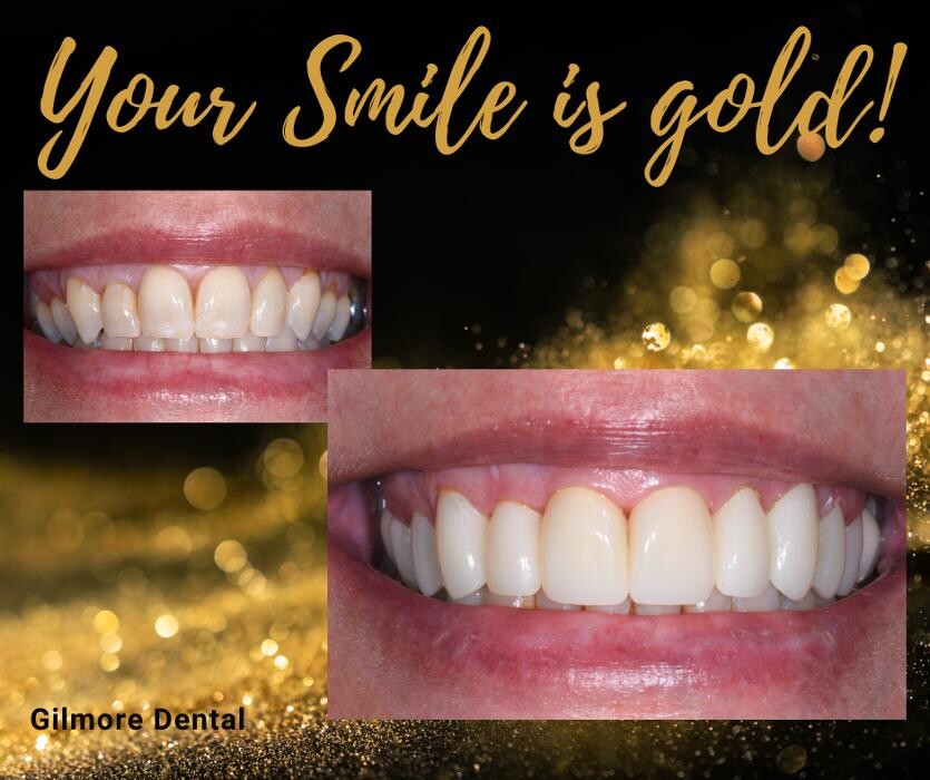 Images Gilmore Dental