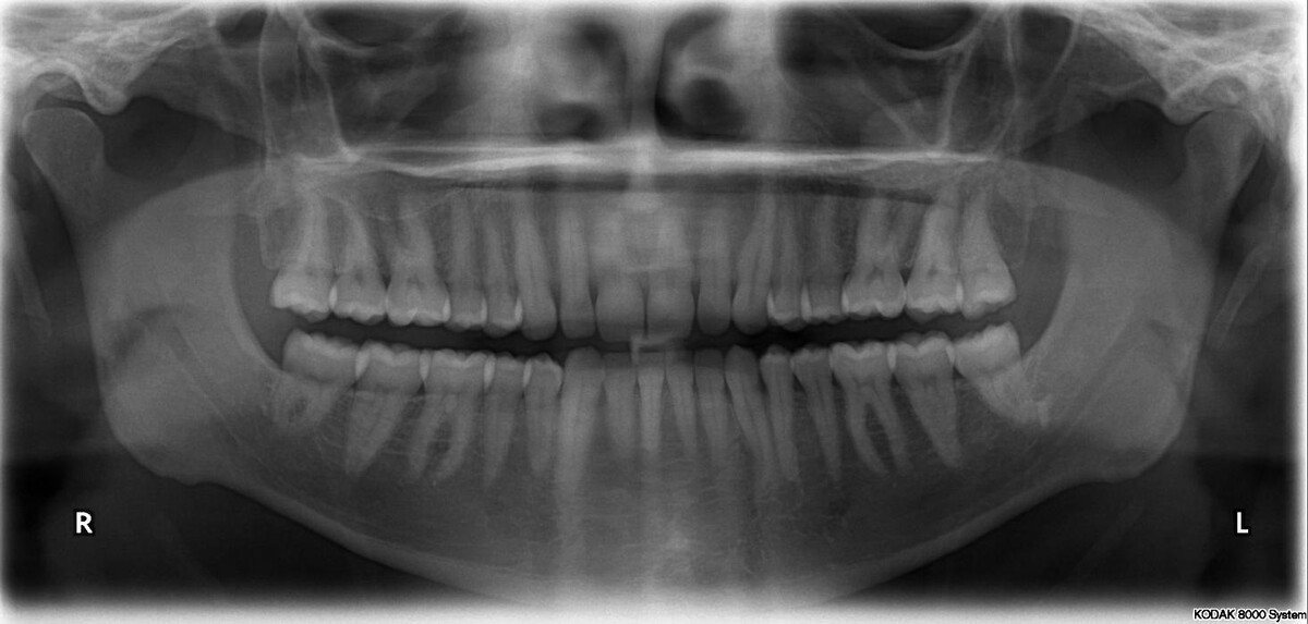 Images Oil City Dental