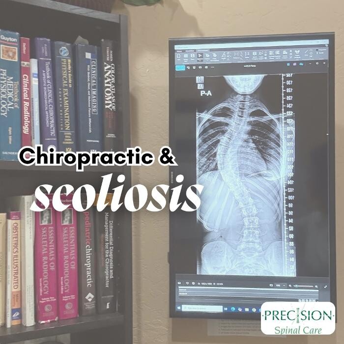 Images Precision Spinal Care