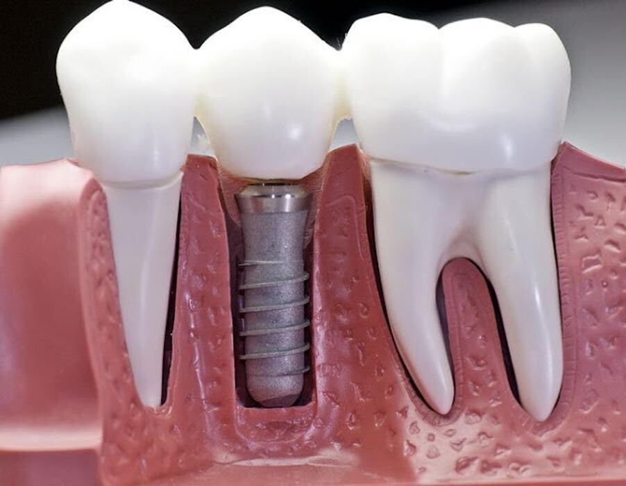Images Murphree Dental