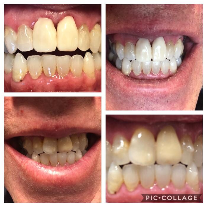 Images Progressive Dental