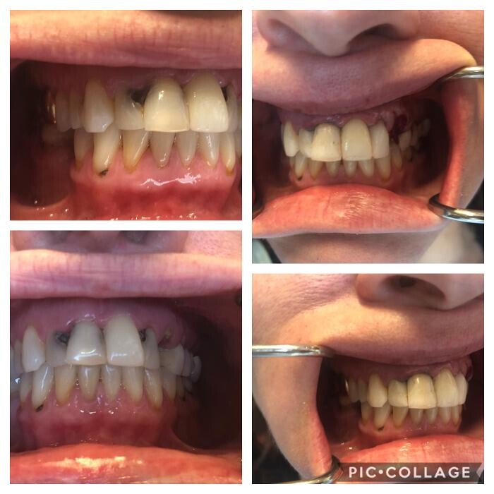 Images Progressive Dental