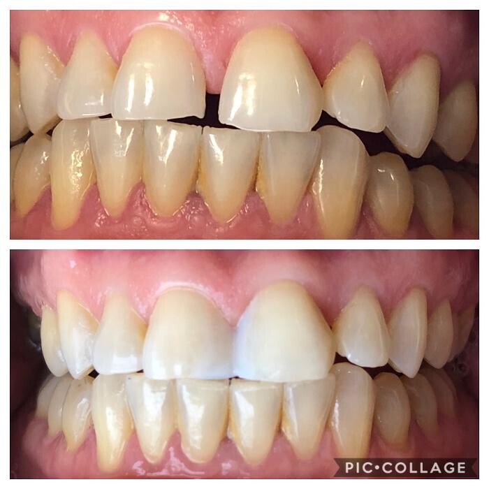 Images Progressive Dental