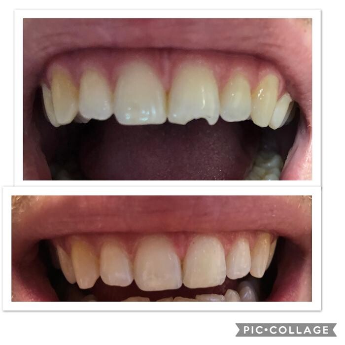 Images Progressive Dental