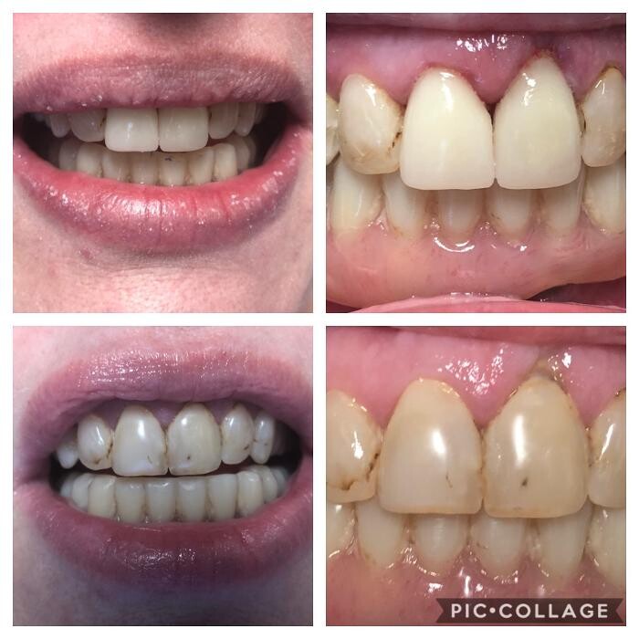 Images Progressive Dental