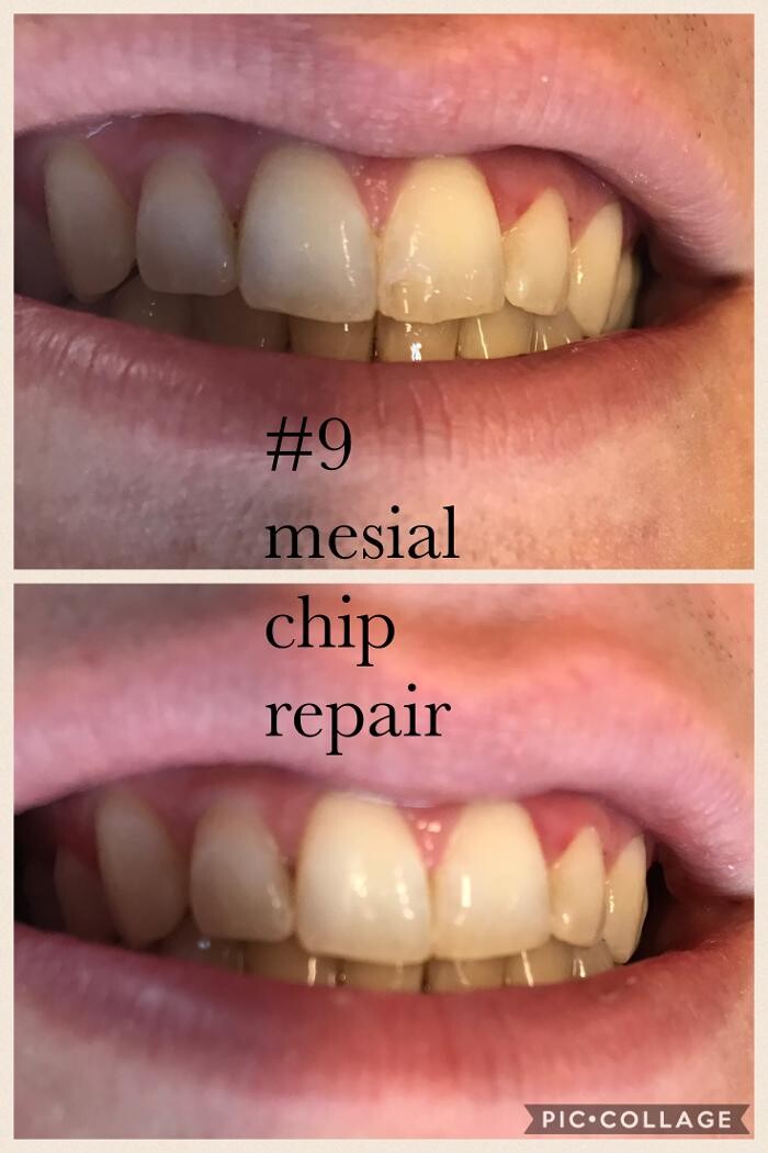 Images Progressive Dental