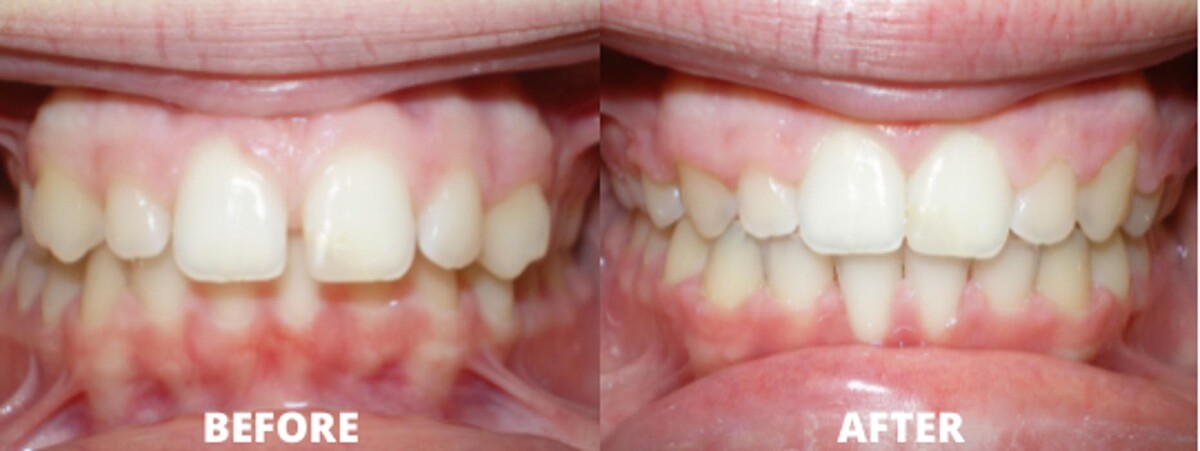 Images Allegany Orthodontics PC