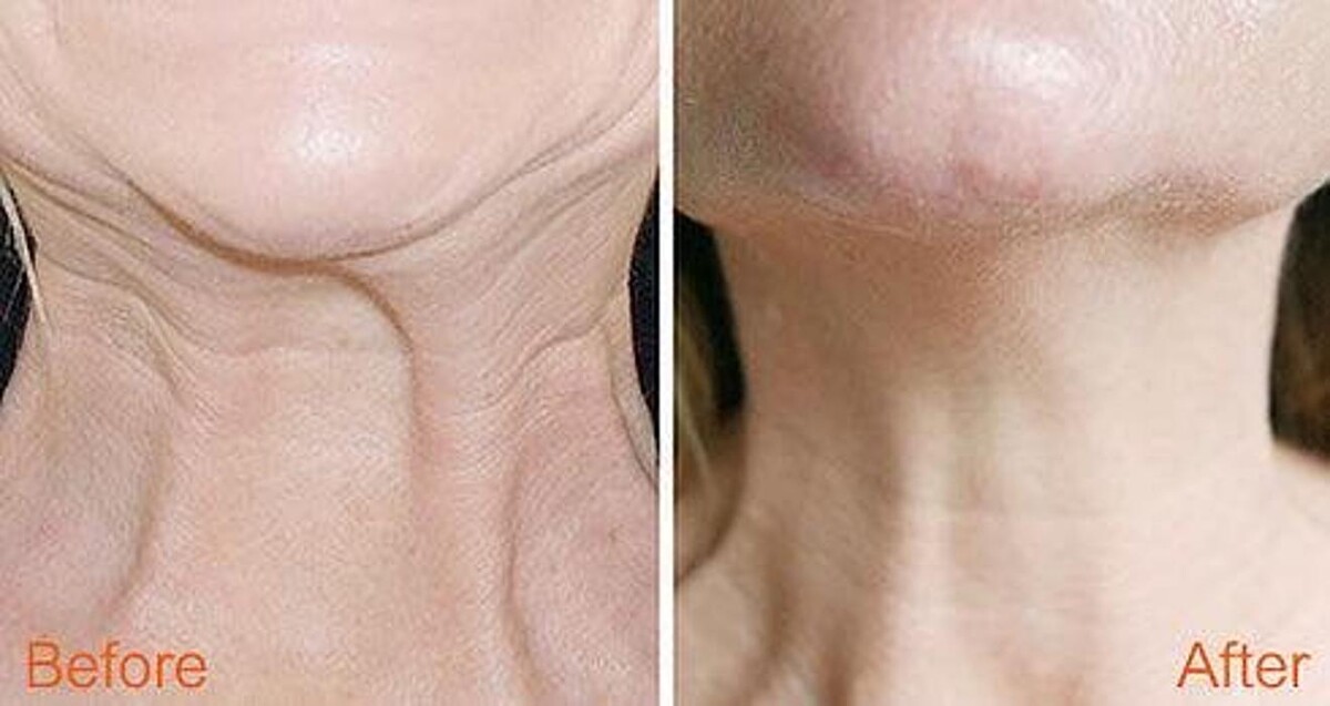 Images Face Fabulous Medical Spa