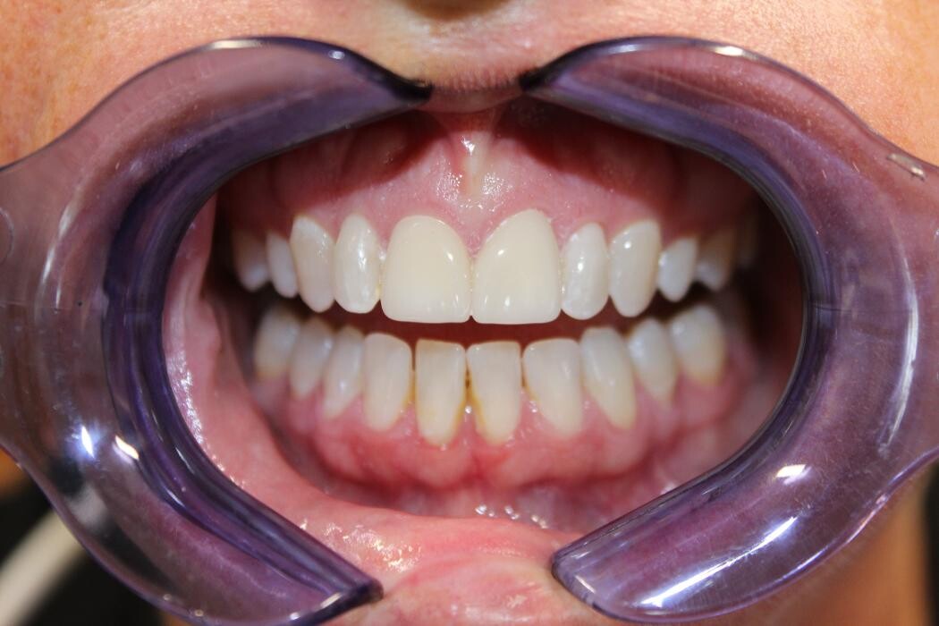 Images Hamilton Family Dentistry